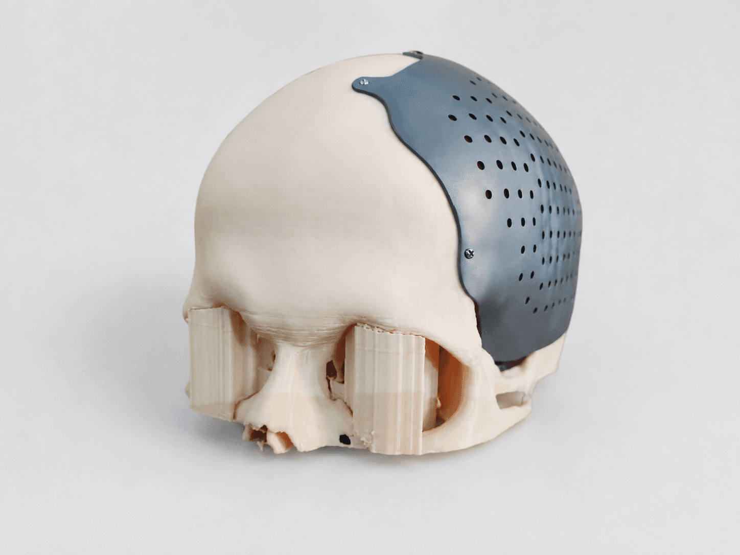 IND Cranial System thumbnail 2