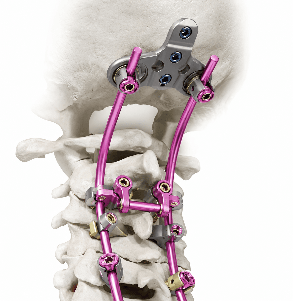 JOYO Lateral Mass System thumbnail 2
