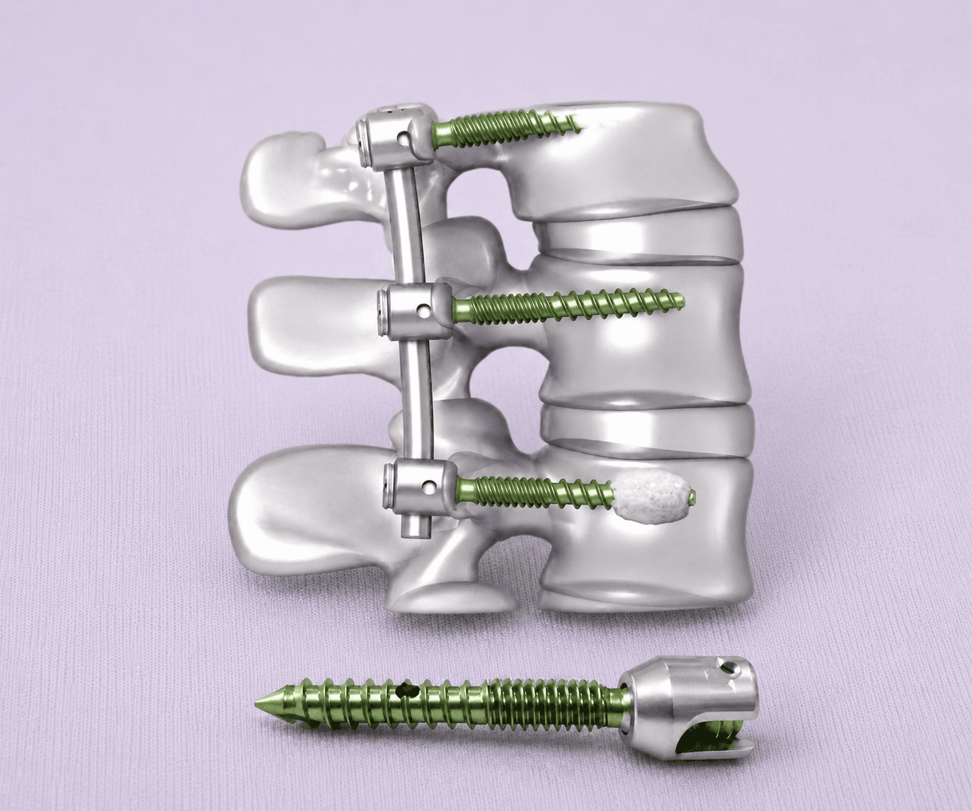 Arrow Pedicle Screw System thumbnail 3