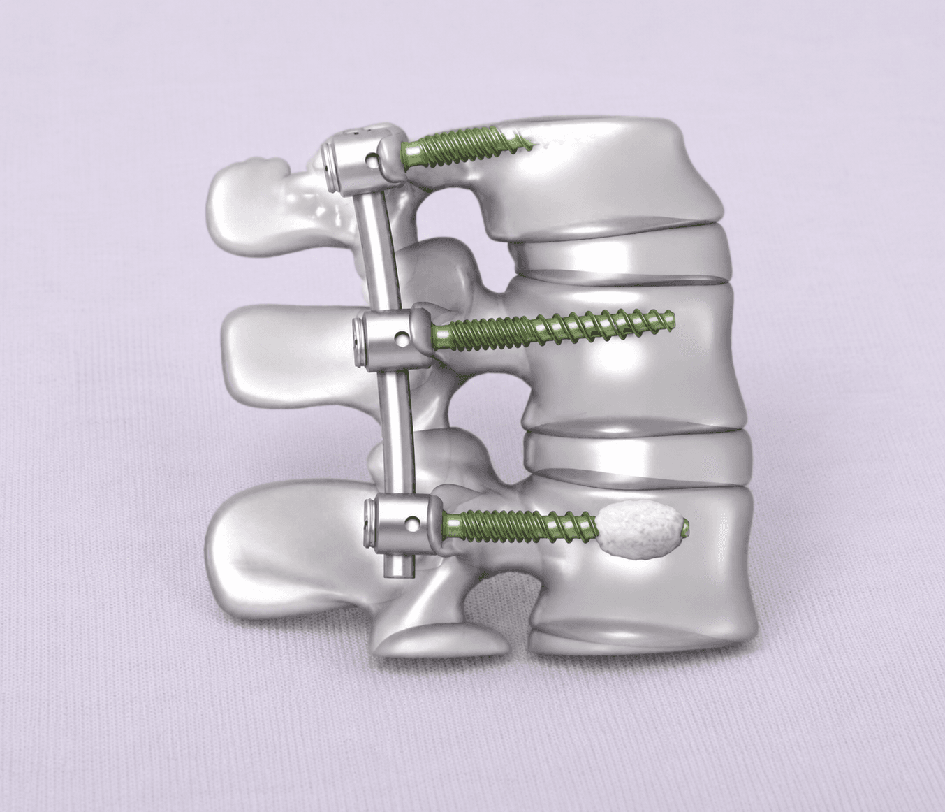 Arrow Fenestrated Screw