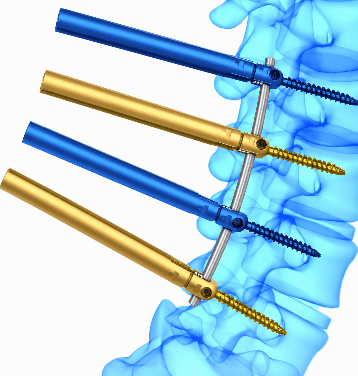 Minimal Invasive Screw System thumbnail 2